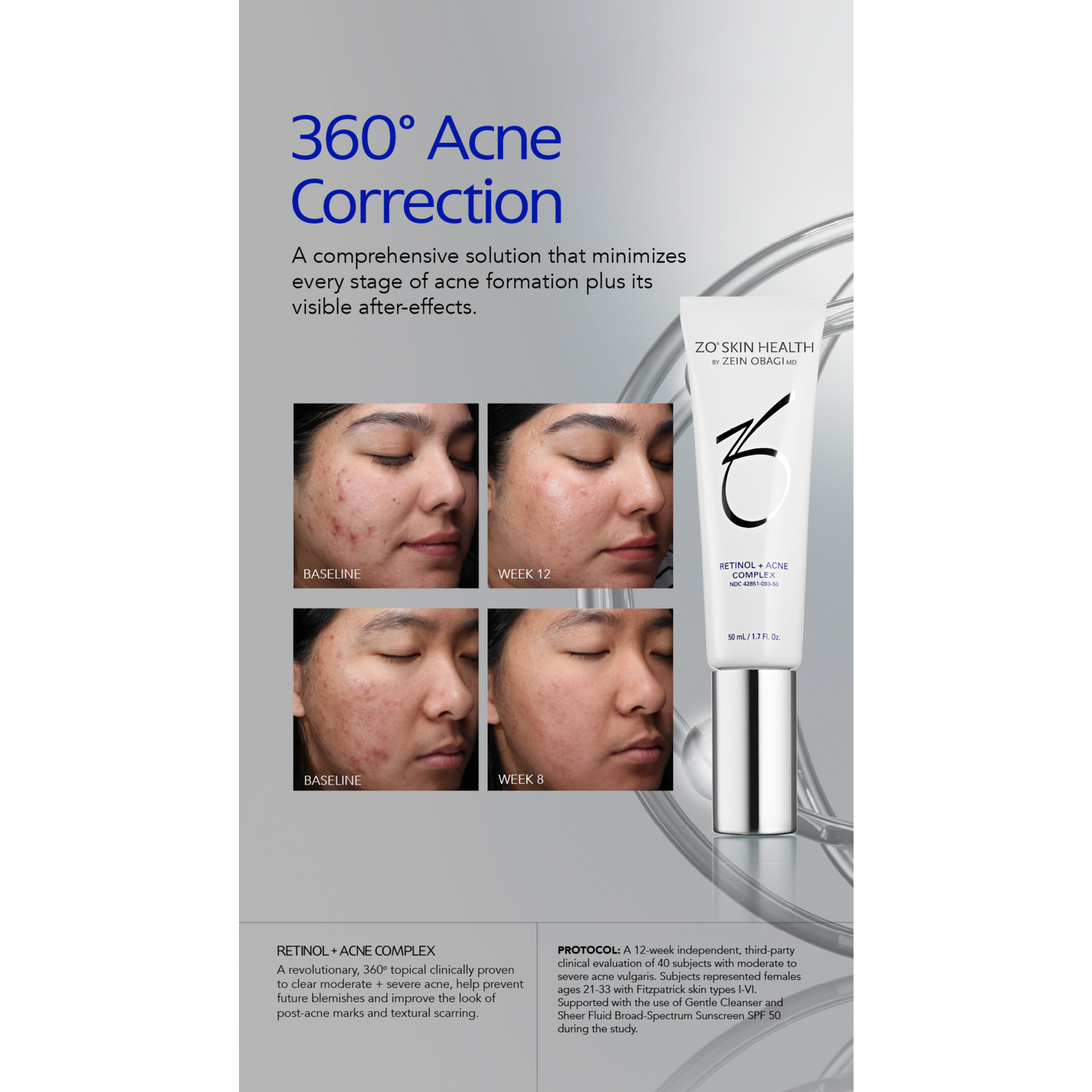 Retinol + Acne Complex